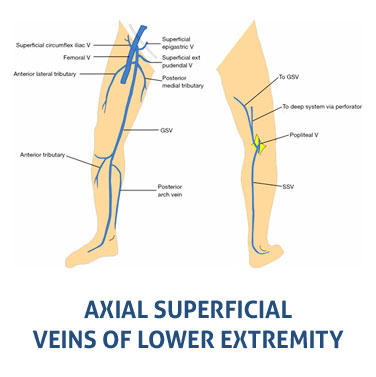 Images Vein Expert