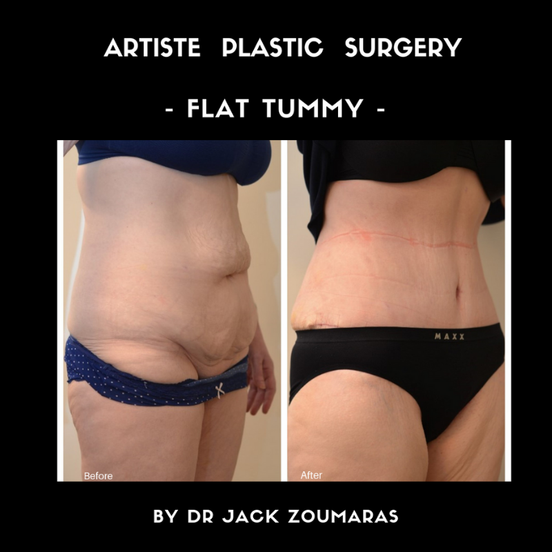 Images Artiste Plastic Surgery - Dr. Jack Zoumaras