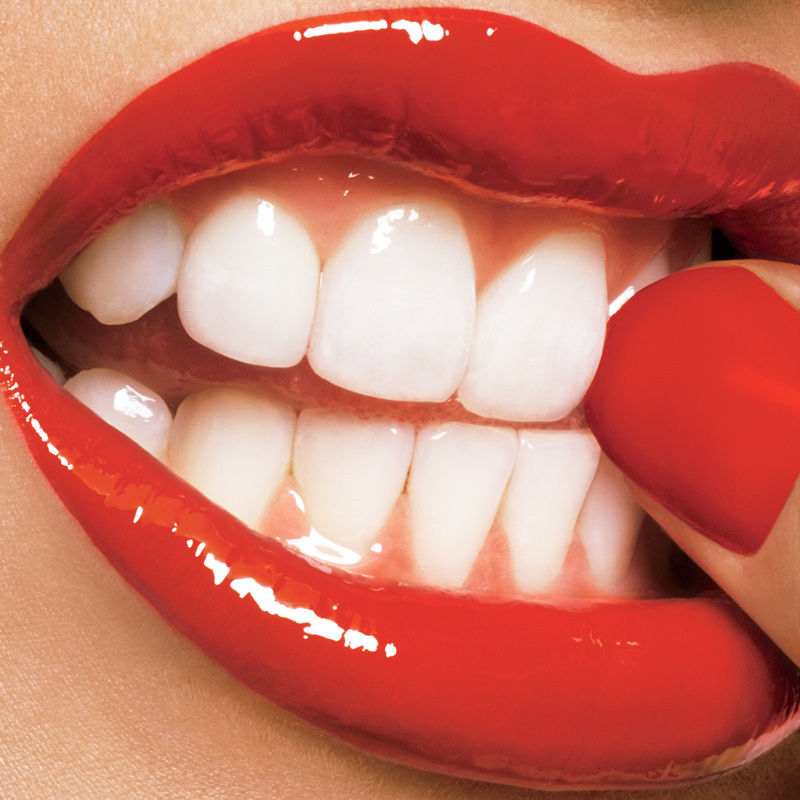 Laser Teeth Whitening