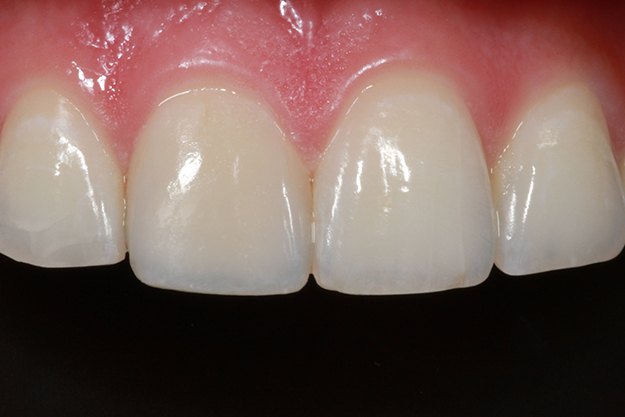 Atlas Dentistry Image