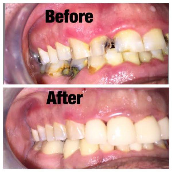 Banyan Tree Dental  Family Dentistry & Orthodontics Photo
