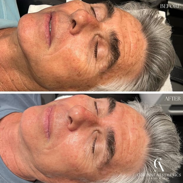 Images Corinne Aesthetics | Laser & Skin