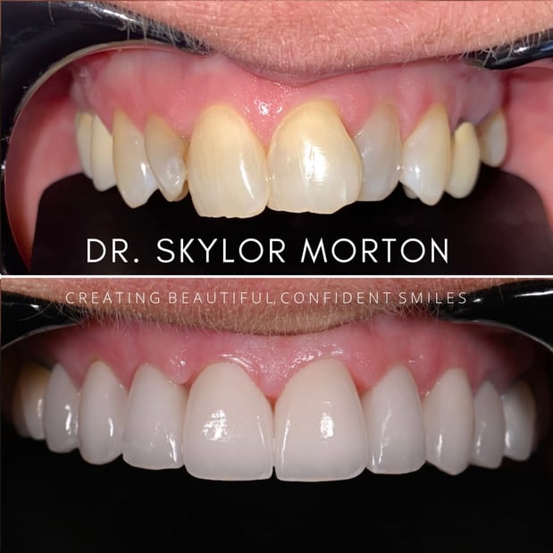 Images Nashville Wisdom Teeth and Implant Solutions