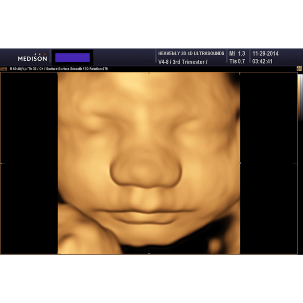 Images Heavenly 3D 4D Ultrasounds
