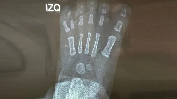 Images Dr. Juan Carlos Torres Archila