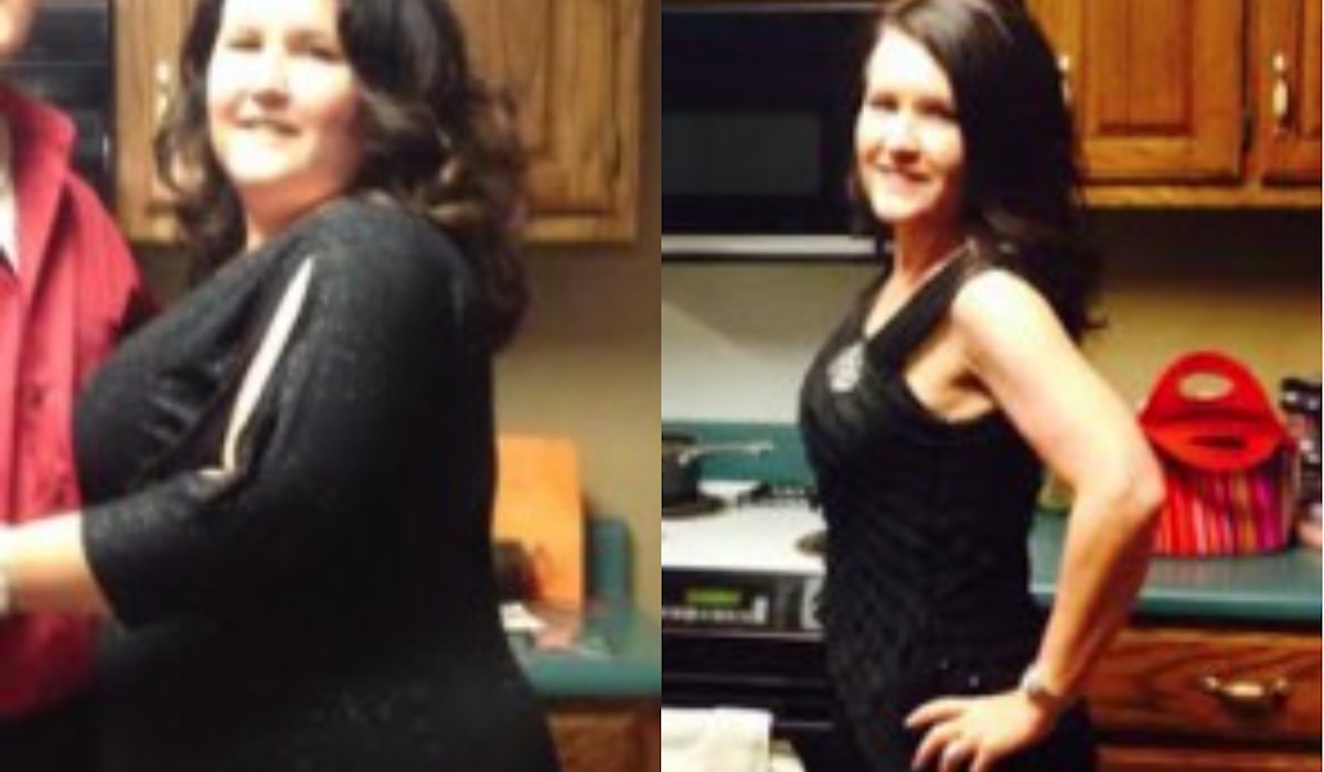Before and After - Gastric Bypass