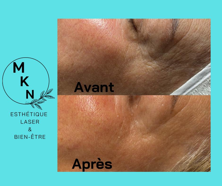 Images MKN Esthétique Laser & Bien-être