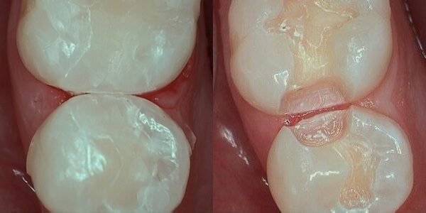 Images Haws Family Dentistry