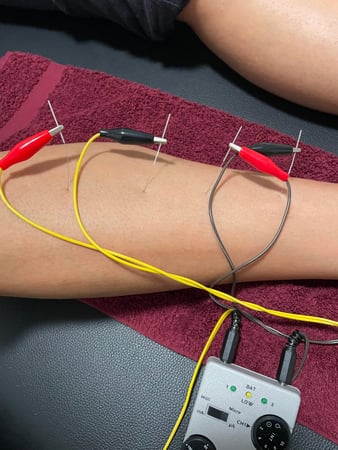 Images Stagg Performance Physical Therapy