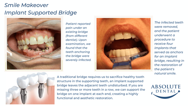 Images Absolute Dental