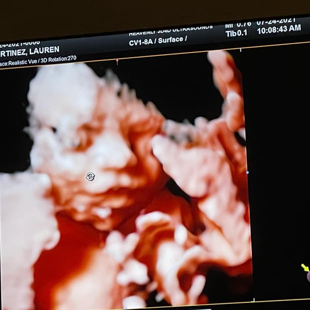 Images Heavenly 3D 4D Ultrasounds