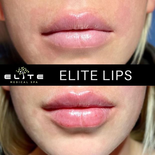 Images Elite Medical Spa of Sarasota