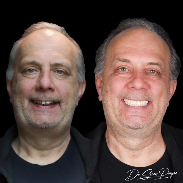 Images Smile Now Denver Dentures and Implants