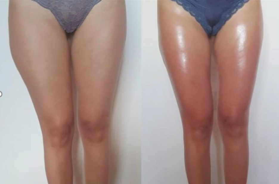 Vacuum Fit 100, Ackerstrasse 16 in Kloten