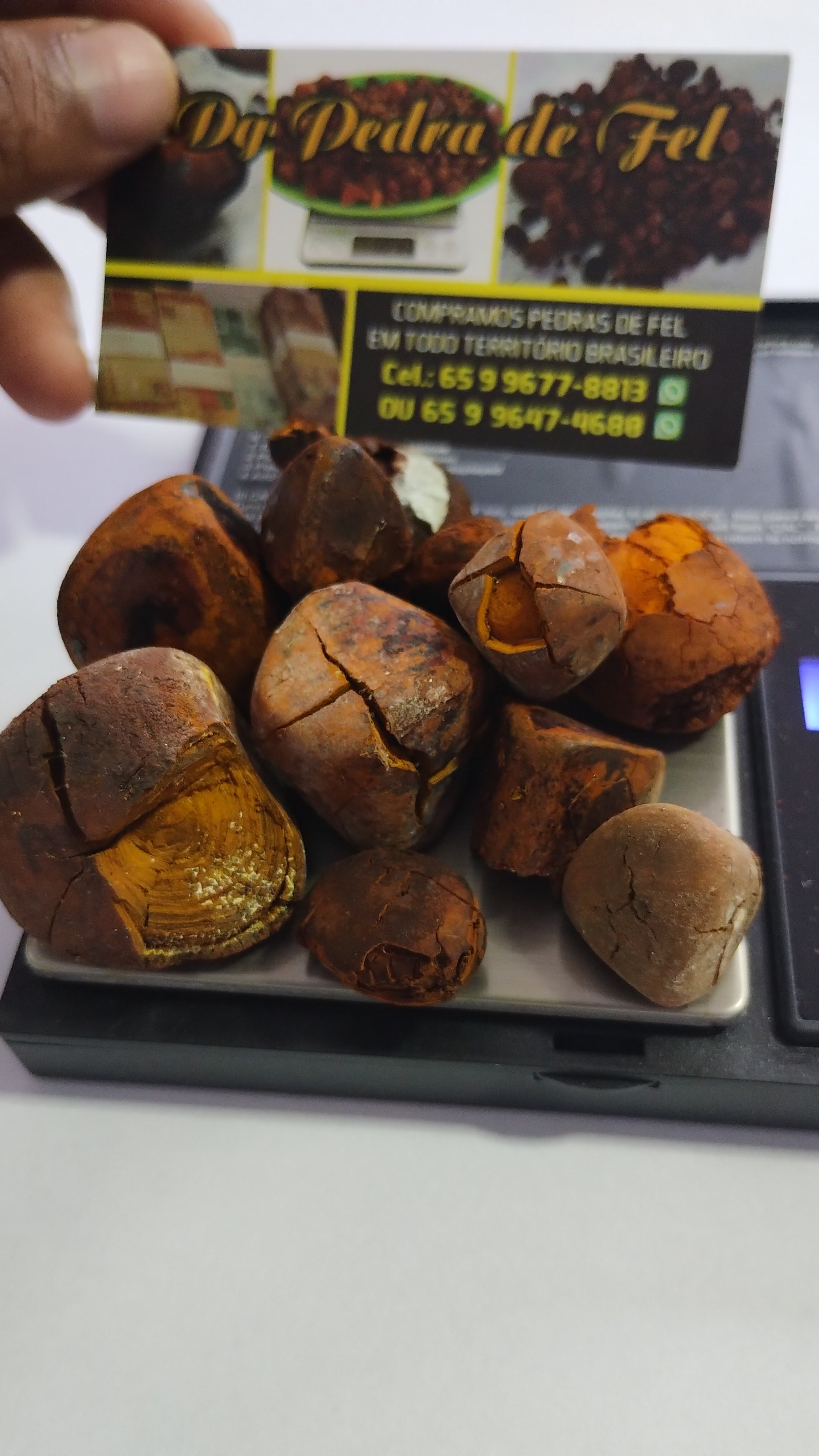 Images Dg pedras de fel bovinos