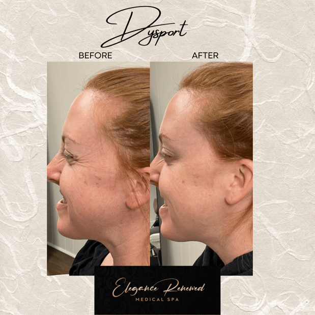 Images Elegance Renewed Medical Spa