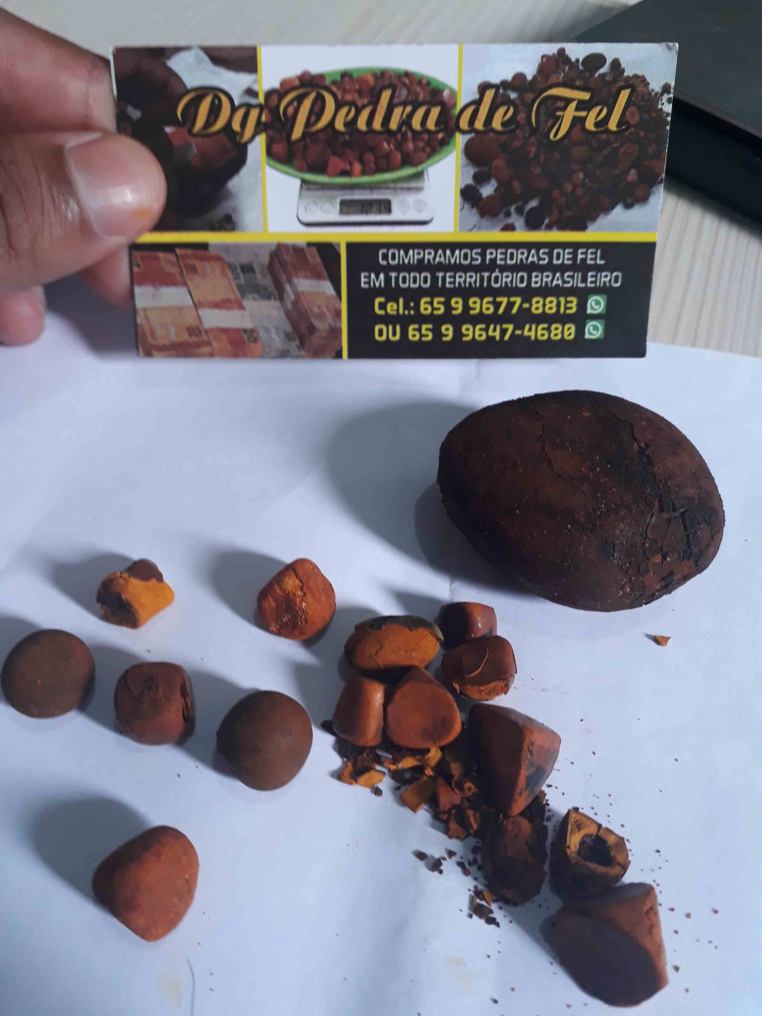 Images Dg pedras de fel bovinos