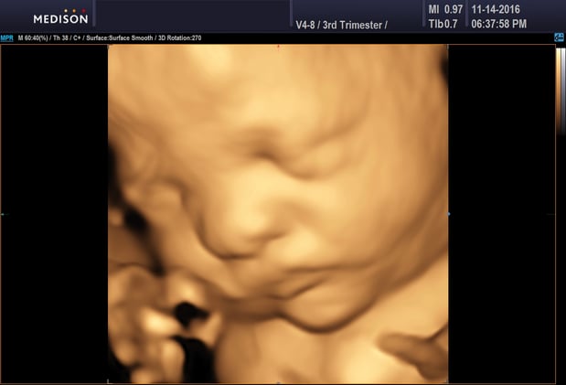 Images Heavenly 3D 4D Ultrasounds