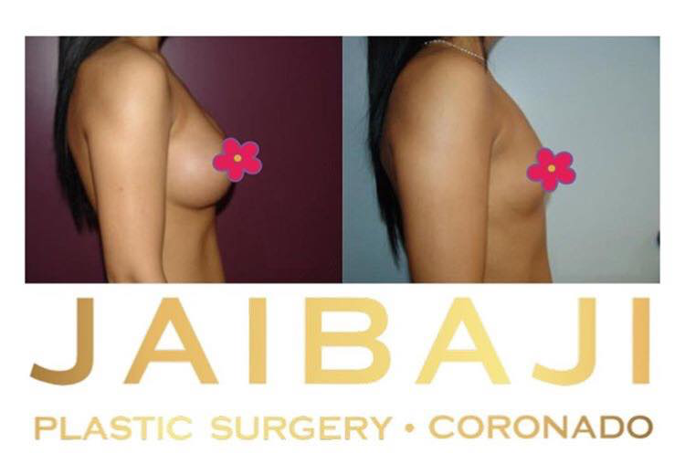 Jaibaji Plastic Surgery Photo