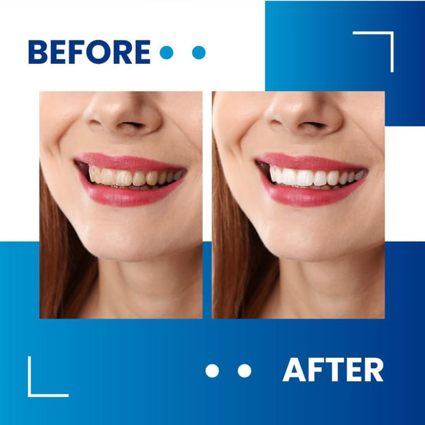 Images Rotem Dental Care