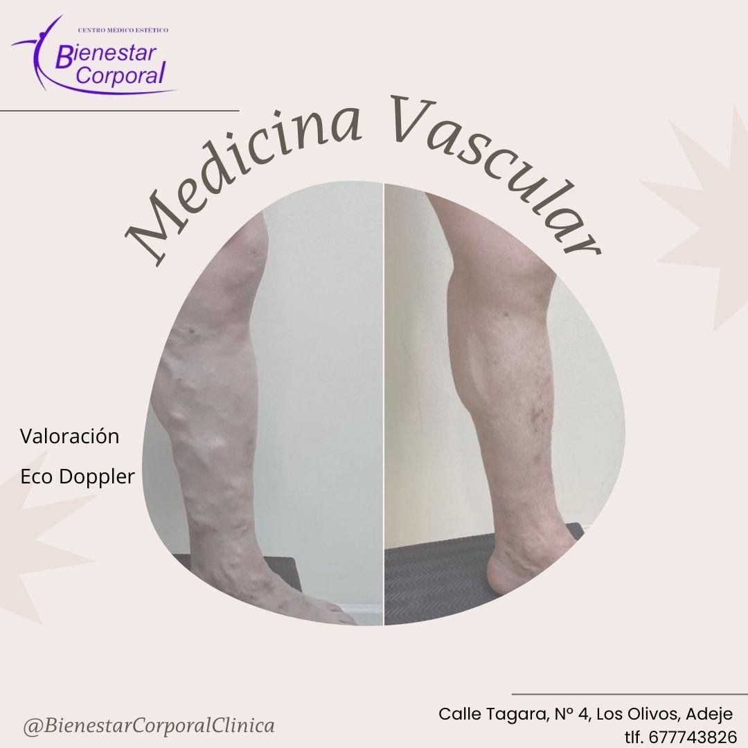 Images Clinica bienestar corporal adeje