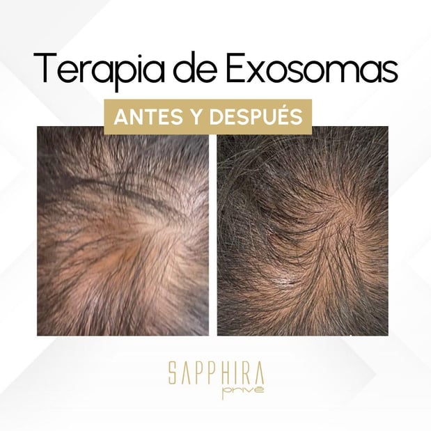 Images Sapphira Prive Winter Garden MedSPA