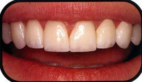 Images Southridge Dental