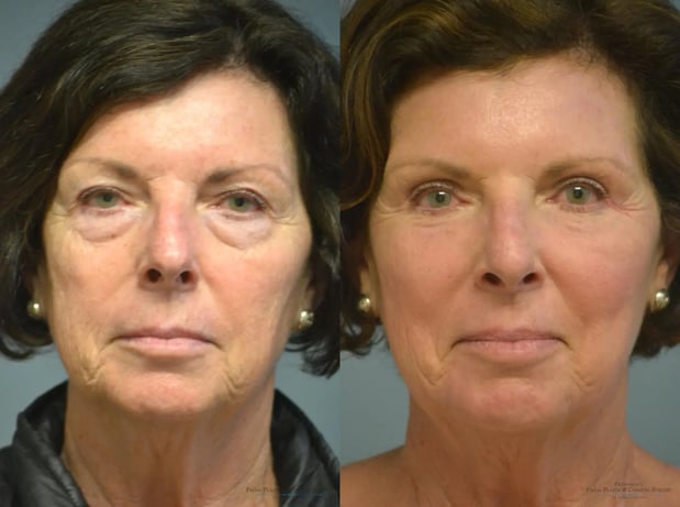 Images Providence Facial Plastic and Cosmetic Surgery
