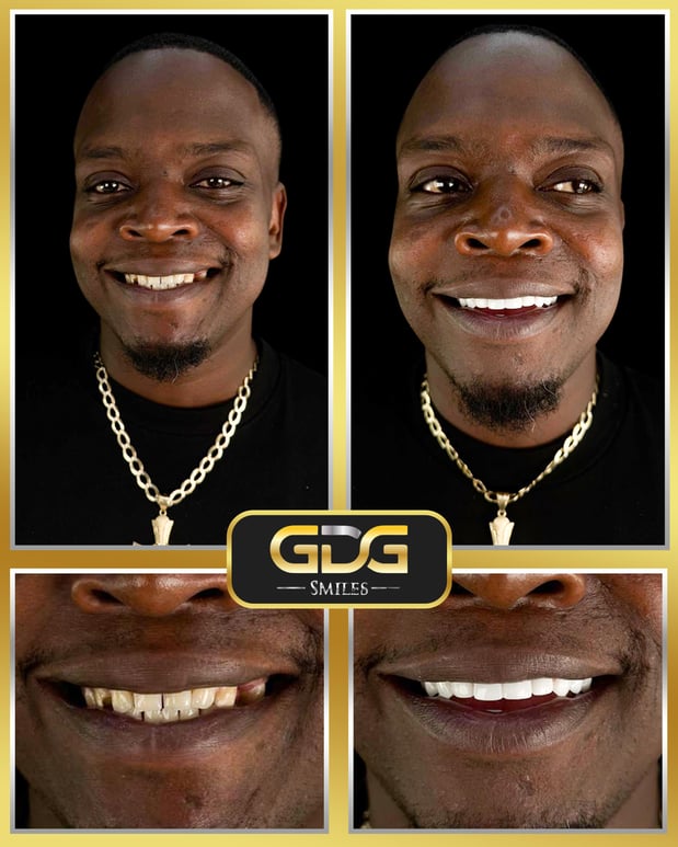 Images GDG Smiles