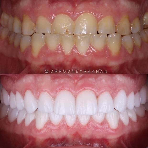 Images Dr. Rodney Raanan