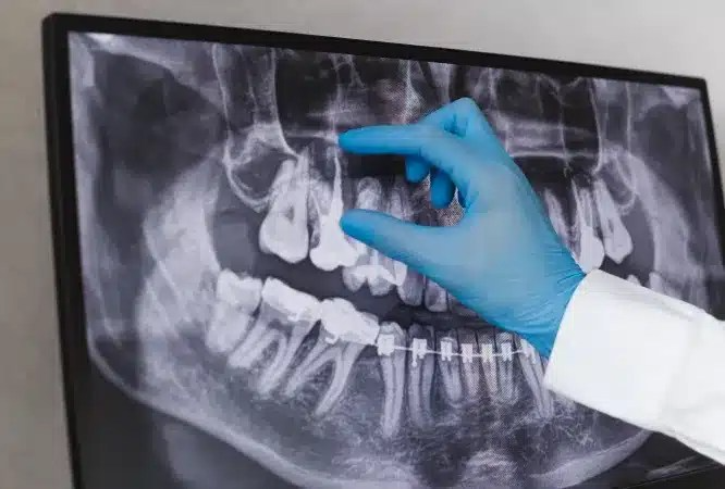 Images Haws Family Dentistry