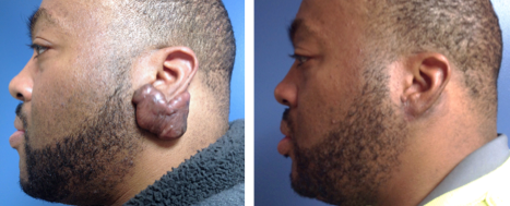 Lexington Plastic Surgeons