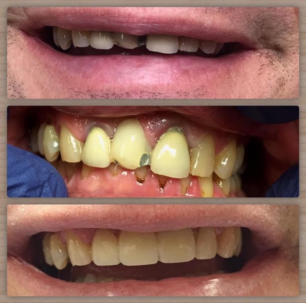Images Paladin Dental