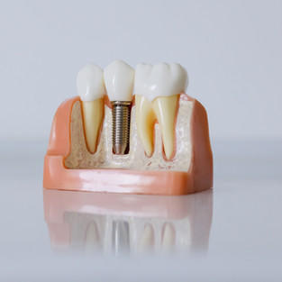 Images 1st Choice Dental