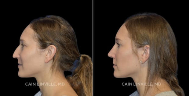 Images Linville Plastic Surgery