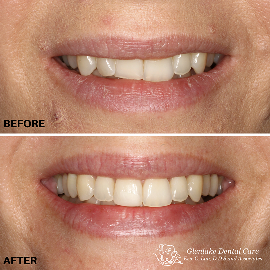 Images Glenlake Dental Care