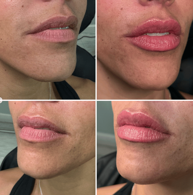 Images Serenity Aesthetics & Wellness