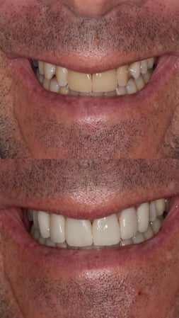 Images Galindo Prosthodontics