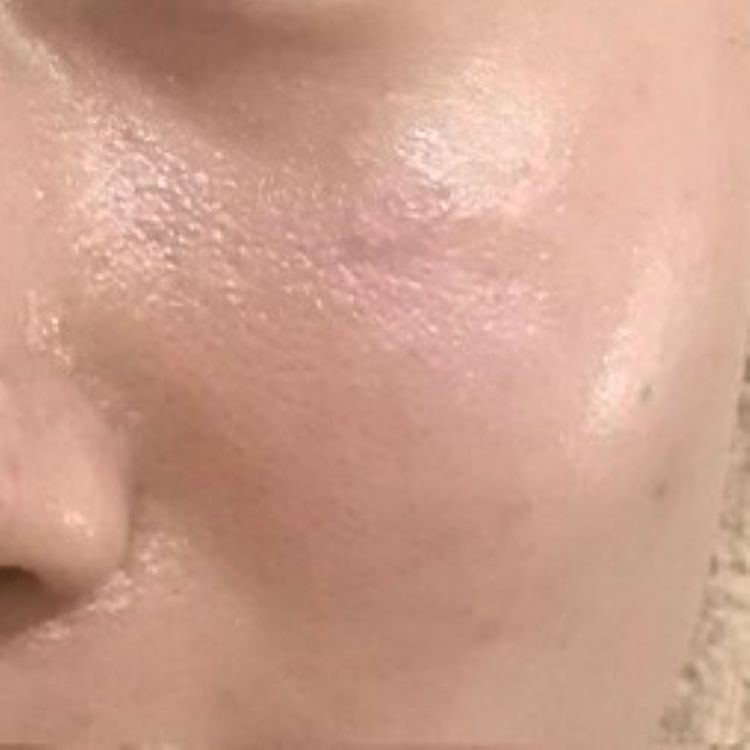 Images 育毛・発毛・頭皮ケア　ヘッドイレブン　名古屋