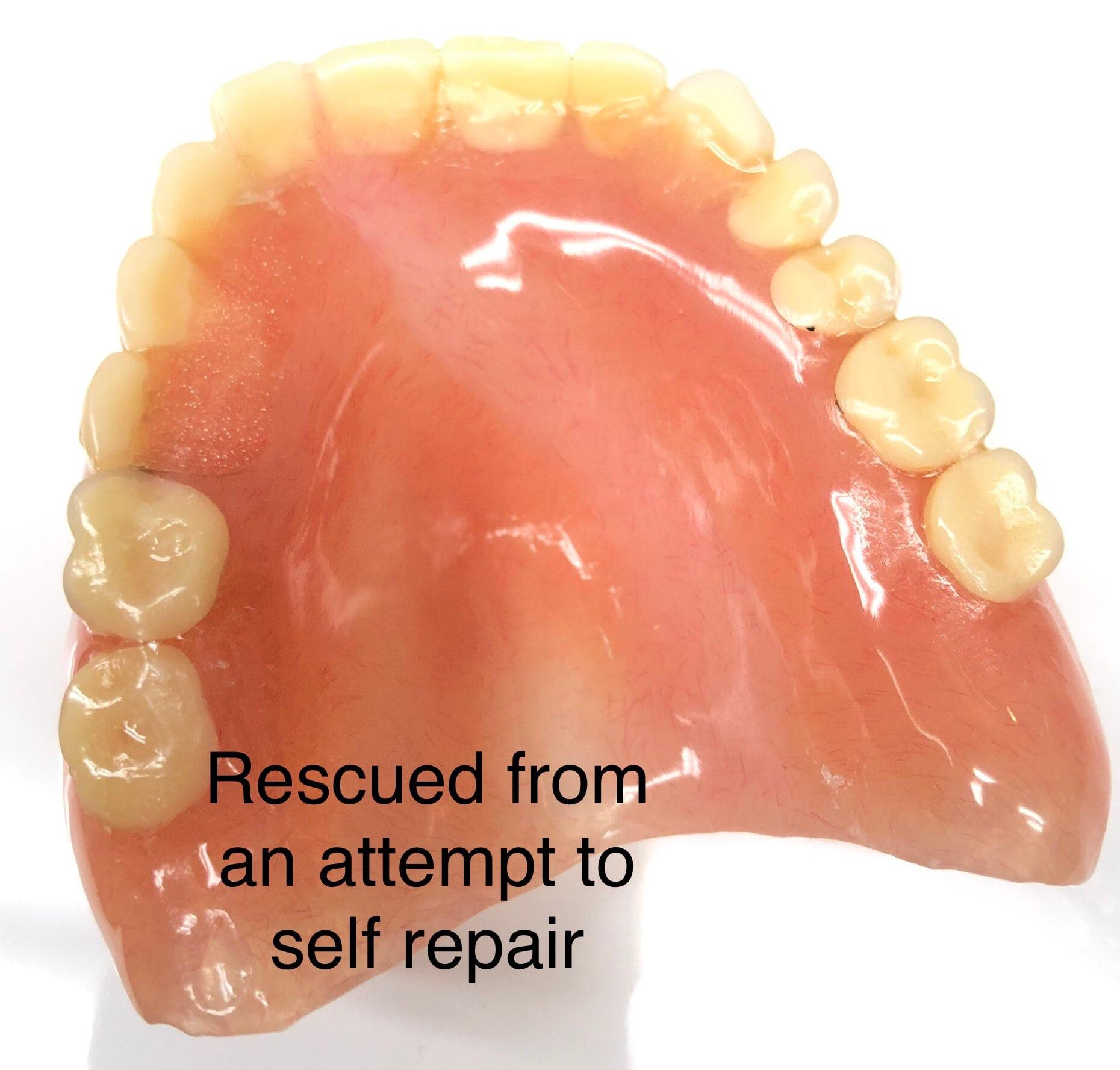 Mobile Denture Repair Rainham 07957 719377
