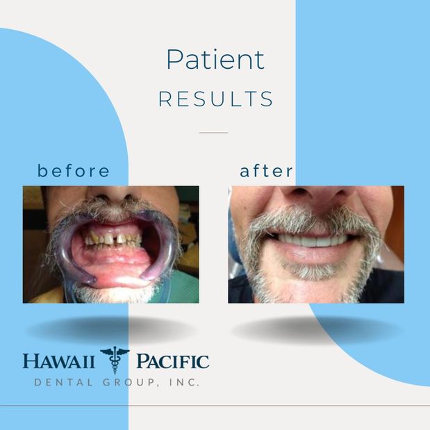 Images Hawaii Pacific Dental Group, Inc.