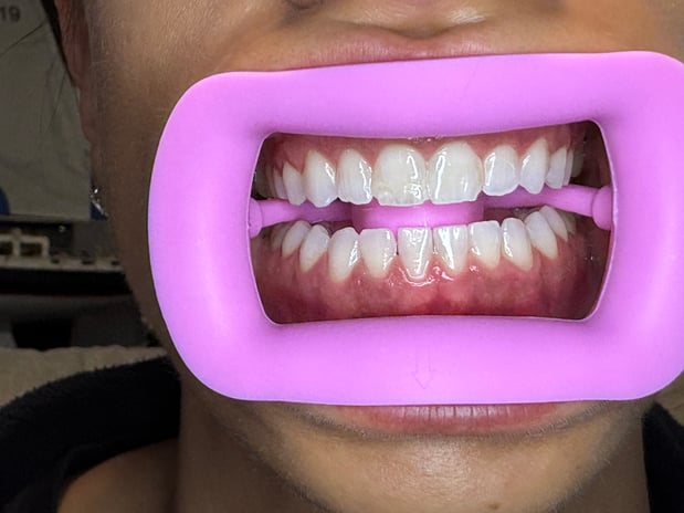 Images Glow White Smile