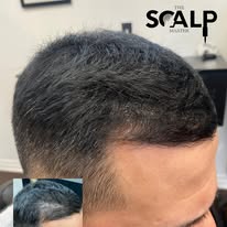 Images The Scalp Master