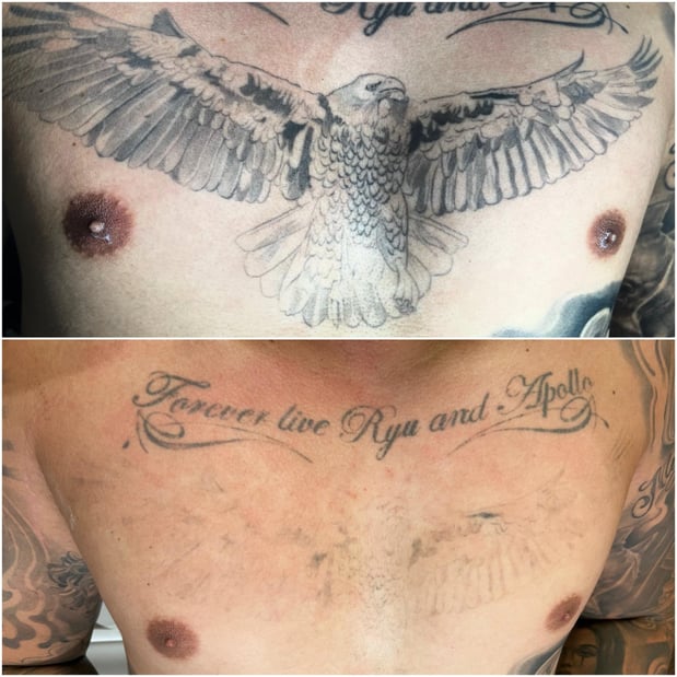 Images TruCanvas Aesthetics