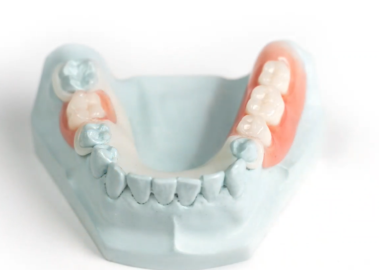 Images European Denture Center: Boise Dentures & Implants