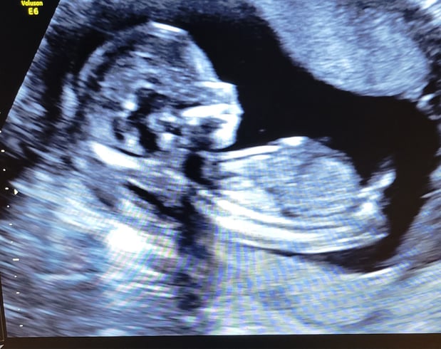 Images Love At First Sight 3D/4D Ultrasound Imaging Studio, LLC