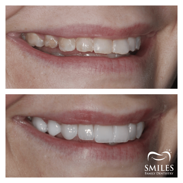 Images Brunswick Smiles Family Dentistry Implant, Oral Surgery, and Cosmetic Dentist