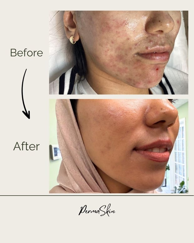 Images Permaskin Beauty Center & Academy