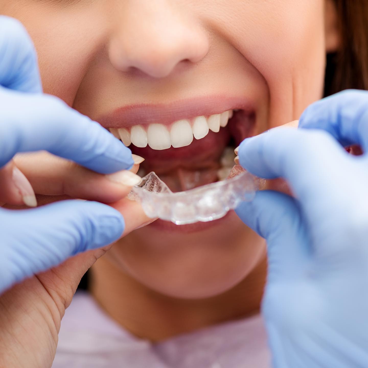 Images Orthodontix Northbridge