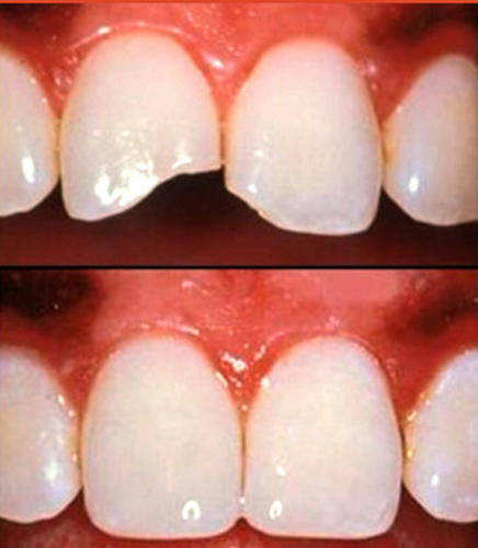 Images Clínica Dental Dra. Kenny Perero Pin